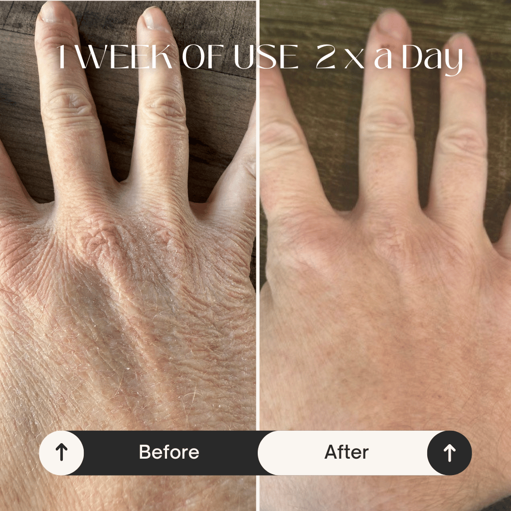 LBM Silk Hands - Intensive Moisture & Repair Serum 30ml - Natural Skincare Moisture Serum - Lily Bee And Me LBM Silk Hands - Intensive Moisture & Repair Serum 30ml Natural Skincare Moisture Serum jc0f5b-4d.myshopify.com