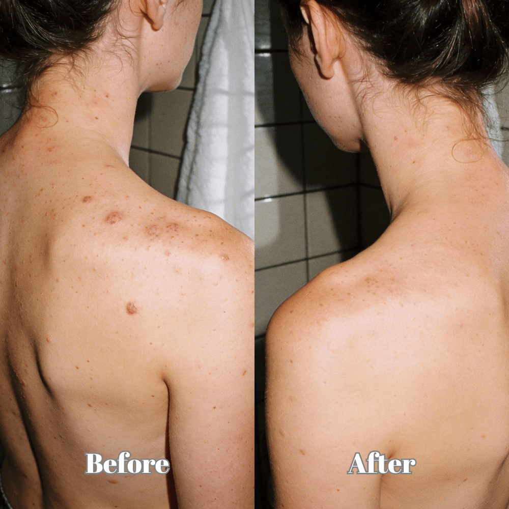 Australian natural blemish treatment serum with Hyaluronic Acid – Pristine5 Blemish Serum supporting clearer skin and refined pores