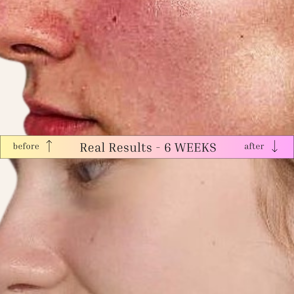 LBM Defy - A Natural Blemish Repair Facial Serum 30ml