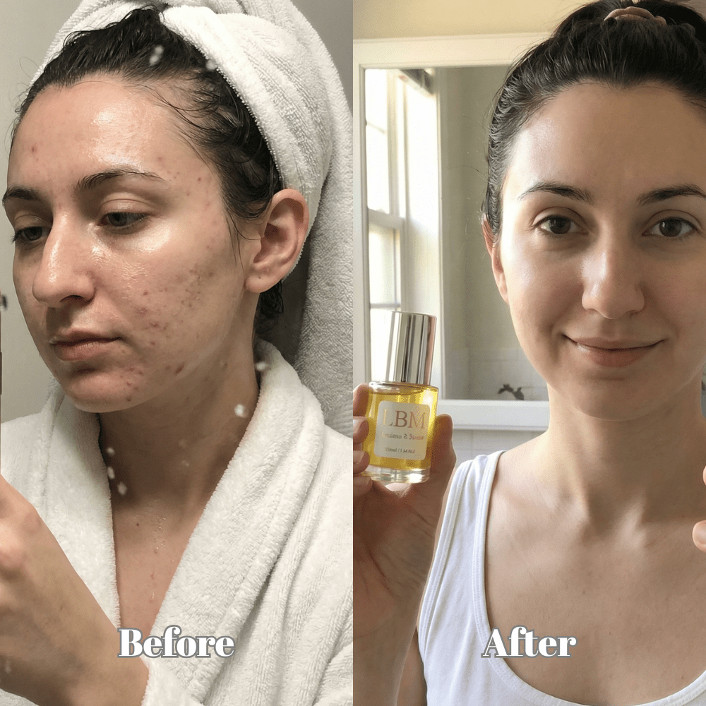 Eco-friendly glass packaging of Pristine5 Magik Blemish Serum – vegan, cruelty-free Australian skincare for blemish-prone skin